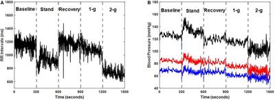 Comparison of Autonomic Control of Blood Pressure During Standing and Artificial Gravity Induced via Short-Arm Human Centrifuge